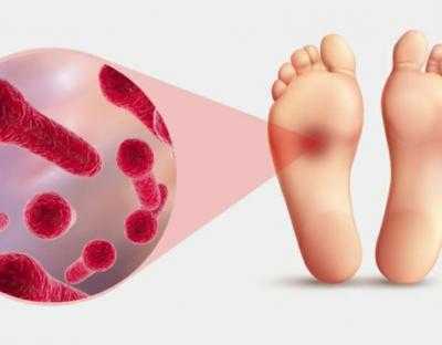 25 квітня - другий день Всесвітнього тижня імунізації: чим небезпечний правець?