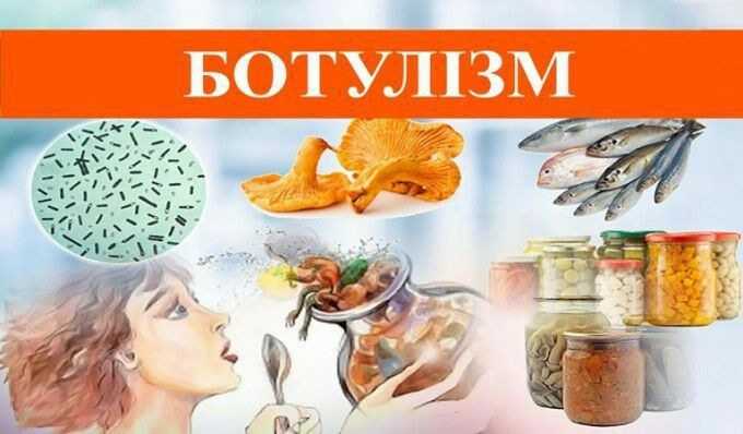 Що необхідно знати про ботулізм: роз’яснення епідеміологів