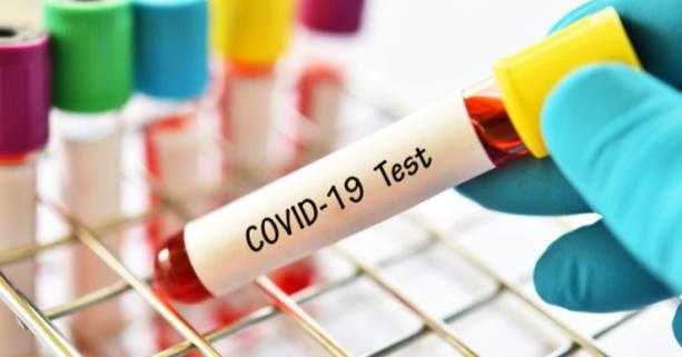 На Львівщині зафіксували 29 нових випадків захворювання на коронавірус