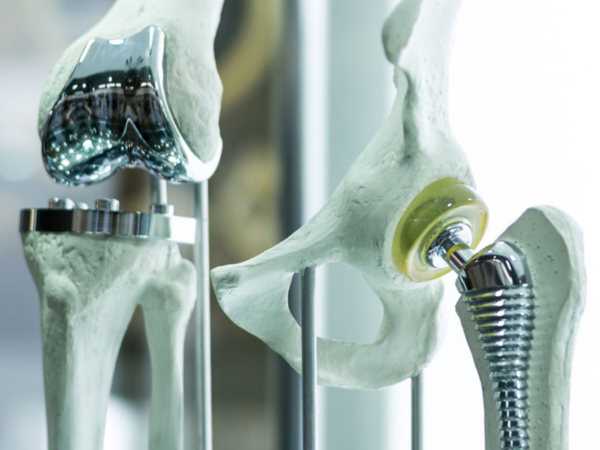 Для мешканців області та переміщених осіб доступне безоплатне ендопротезування