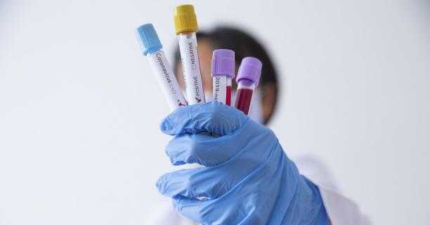 На Львівщині зафіксували 30 нових випадків захворювання на коронавірус