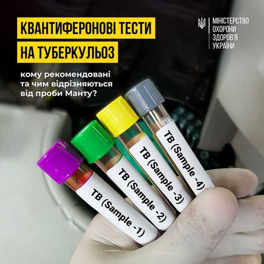 В Україні для виявлення туберкульозної інфекції використовують інноваційні квантиферонові тести