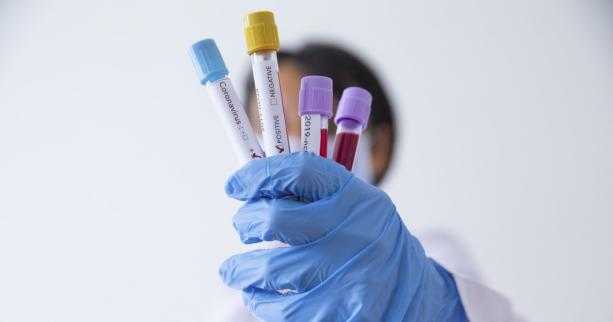 На Львівщині зафіксовано 104 нових випадки захворювання на коронавірус